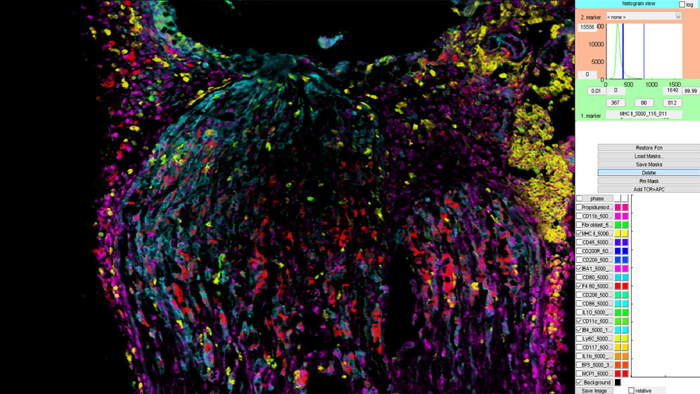 Fluoreszenzaufnahme_von_verschiedenen_Immunzellen_Fraunhofer_IME.jpg Fluoreszenzaufnahme von verschiedenen Immunzellen