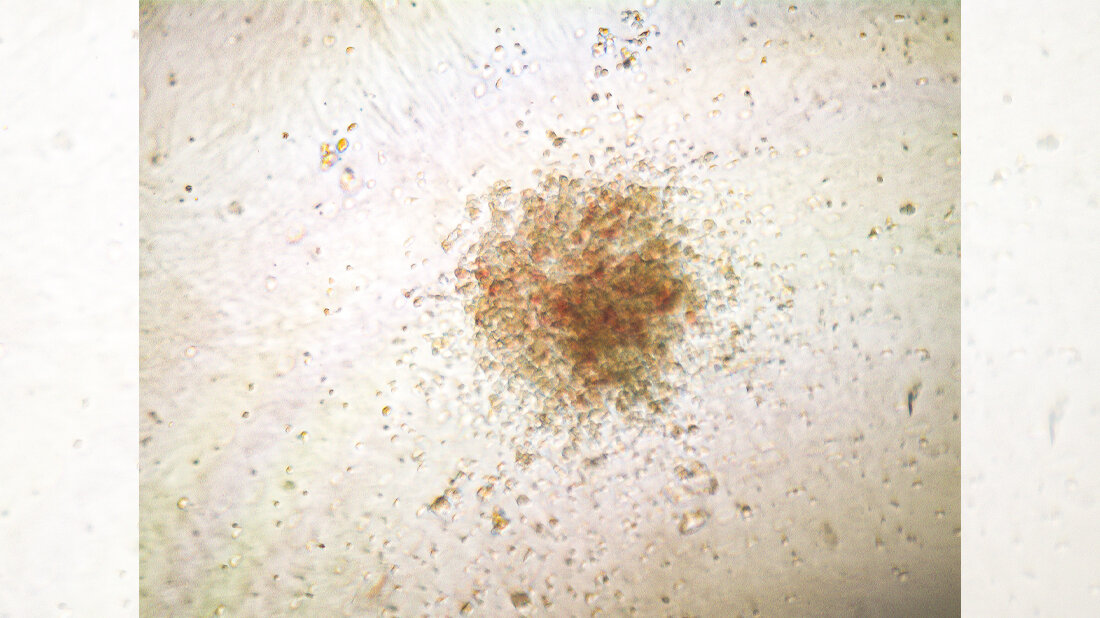 Zellkolonie_AG_Klaus_Rajewsky_MDC.jpg Zellkolonie aus mit der Genschere reparierten menschlichen blutbildenden Stammzellen.