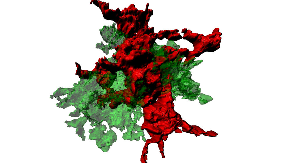 Fresszellen_des_Gehirns_Universitaetsklinikum_Freiburg.jpg Fresszellen des Gehirns (Mikroglia)