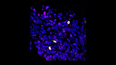 Produktion_des_Proteins_BCOR_L_Kutscher_KiTZ.jpg Produktion des Proteins BCOR