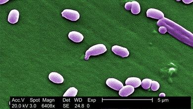 Bacillus_anthracis_Janice_Haney_Carr_CDC_Laura_Rose_gemeinfrei.jpg Bacillus anthracis