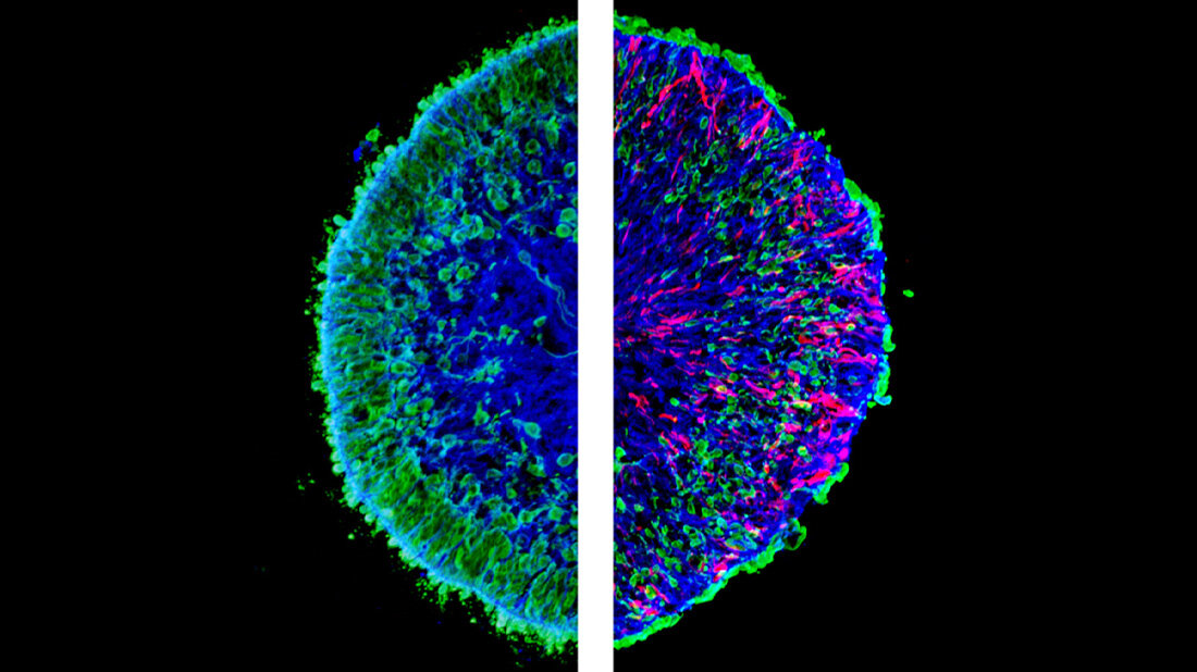 Netzhaut_Organoid.jpg Mikroskopische Aufnahmen von im Labor gezüchteten Mini-Netzhäuten