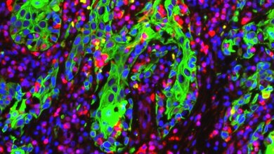 Stachelzellkrebszellen_gruen_dringen_in_Haut_ein_Venugopal_Rao_Mittapall_11032016i.jpg Stachelzellkrebszellen_gruen_dringen_in_Haut_ein_Venugopal_Rao_Mittapall_11032016i.jpg