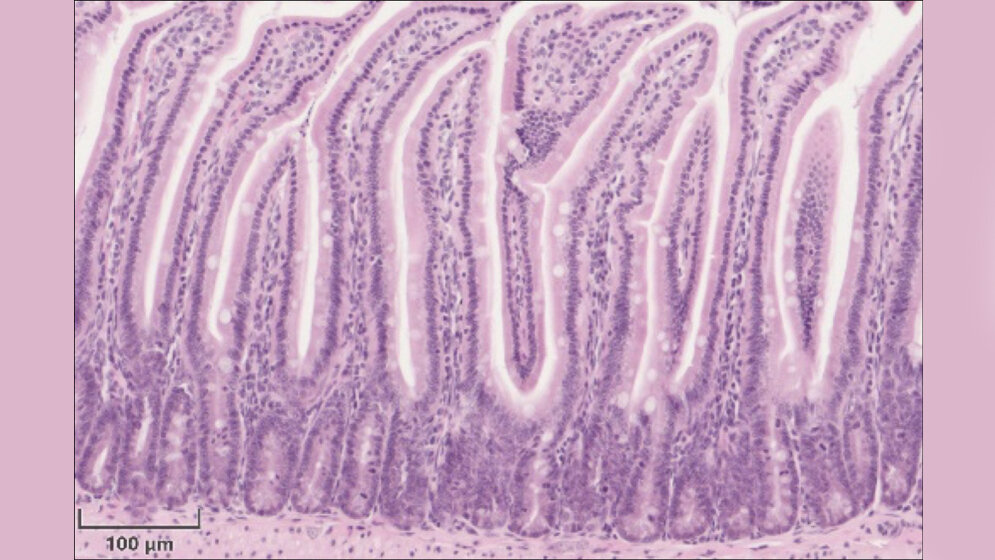 Haematoxylin_Eosin_Faerbung_des_Duenndarms_einer_gesunden_Maus_Quelle_Prof_Dirk_Haller_TUM.jpg Hämatoxylin-Eosin-Färbung