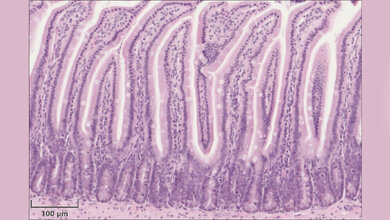 Haematoxylin_Eosin_Faerbung_des_Duenndarms_einer_gesunden_Maus_Quelle_Prof_Dirk_Haller_TUM.jpg Hämatoxylin-Eosin-Färbung