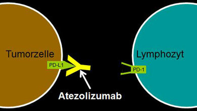 Lungenkrebs_Antikoerper_Atezolizumab_der_PD_Liganden_blockiert_privat_17052016.jpg Antikörper Atezolizumab