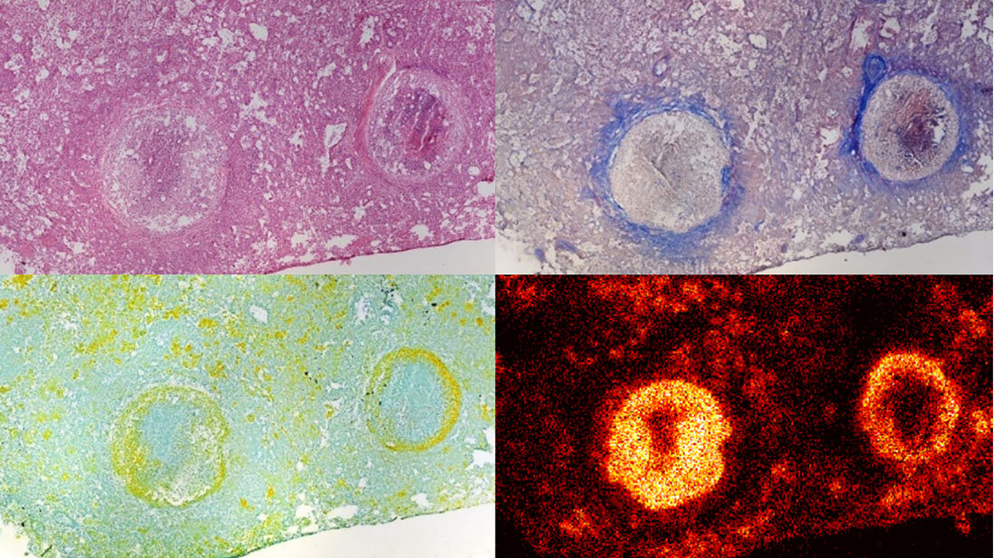 TB_Granulome.jpg Granulomstruktur und Verteilung des Antibiotikums BTZ-043