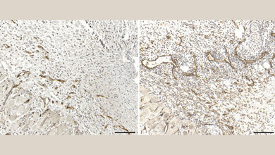 Immunhistochemische_Darstellung_von_Blutgefaessen_in_Hautverletzungen_UZH.jpg Immunhistochemische Darstellung von Blutgefäßen in Hautverletzungen