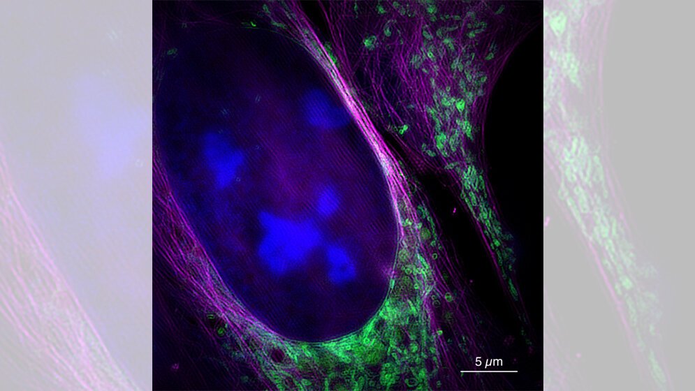 Aufnahme_des_neuen_Mikroskops_Uni_Bielefeld_W_Huebner.jpg Aufnahme des neuen Mikroskops