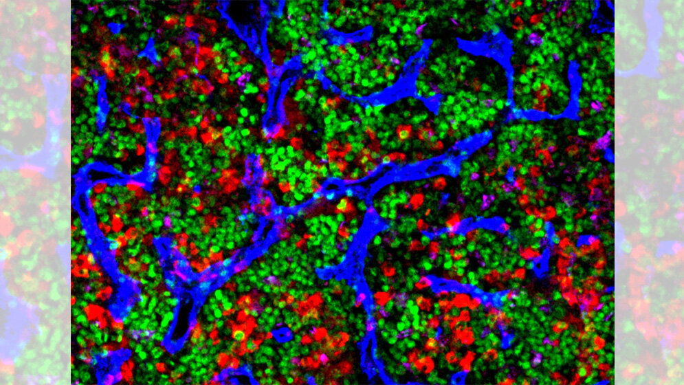 Mikroskop_Aufnahme_von_altem_Knochenmark_Mehmet_Sacma_Uni_Ulm.jpg Mikroskop. Aufnahme von altem Knochenmark