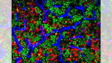 Mikroskop_Aufnahme_von_altem_Knochenmark_Mehmet_Sacma_Uni_Ulm.jpg Mikroskop. Aufnahme von altem Knochenmark