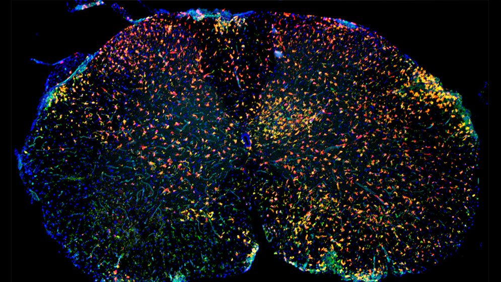 Immunfluoreszenz_von_entzuendlich_veraendertem_Rueckenmark_MJC_Jordao_Uniklinikum_Freiburg.jpg Immunfluoreszenz von entzündlich verändertem Rückenmark