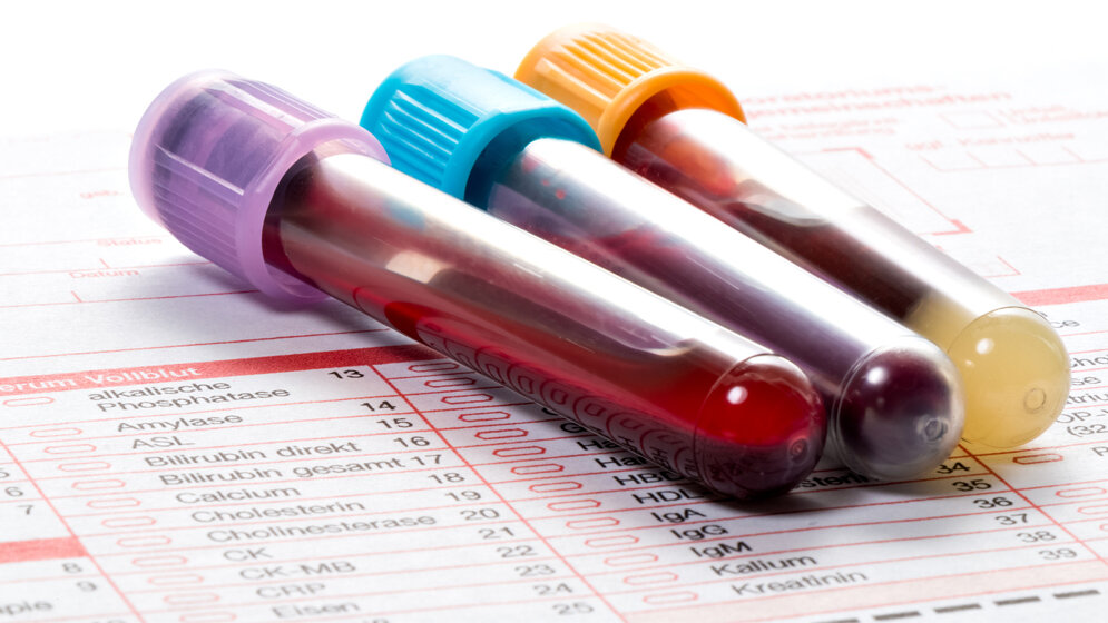 Labor_Henrik_Dolle_stock_adobe_com.jpg Laborumfrage