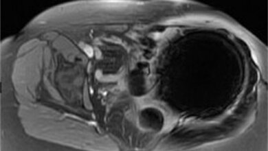 MRT-Sequenzen im Überblick (Teil 2) Bildgebende Verfahren
