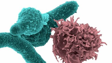 Plzinfektion_COVIS_19.jpg Plzinfektion_COVIS_19.jpg