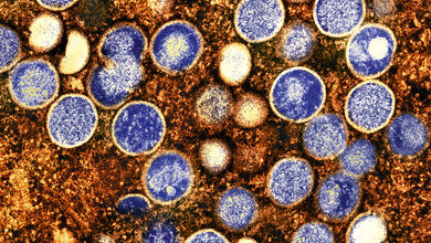 Mpox (Affenpocken) Aufnahme von Mpox-Viruspartikeln