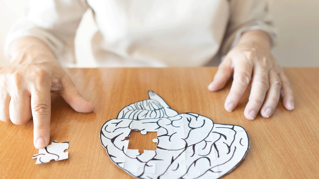 Alzheimer AdobeStock_279796511_2_.gif