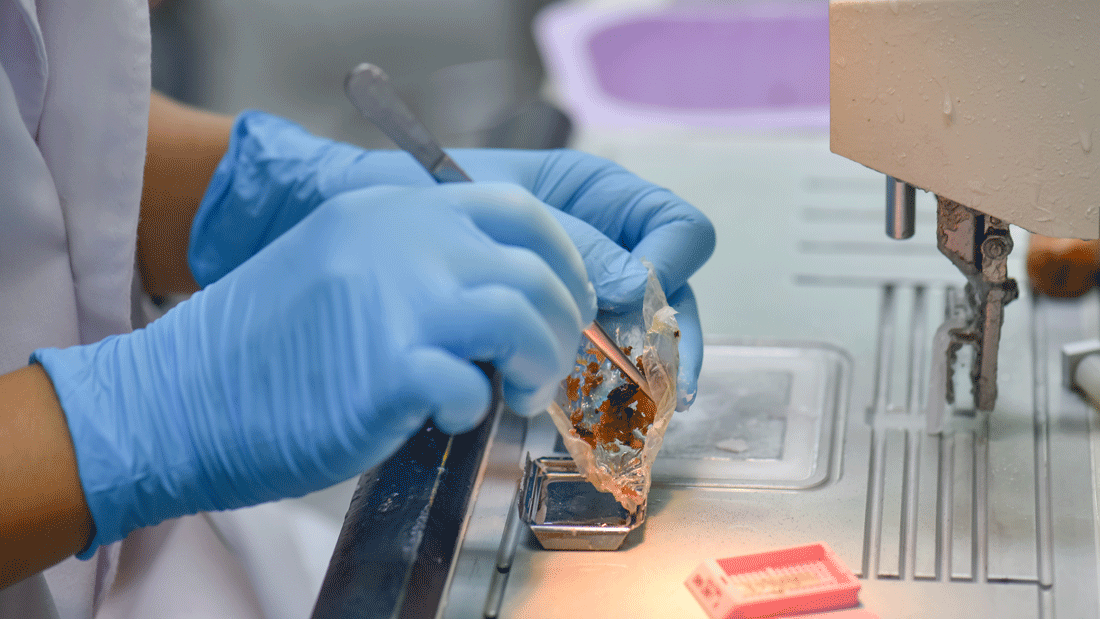 Pathologie AdobeStock_579783430.gif