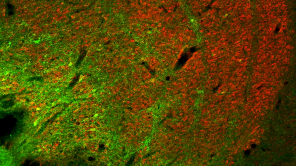 Angefaerbte_Koniozellen_im_Corpus_geniculatum_laterale_gruen_Carsten_Klein_MPI_fuer_biologische_Kybernetik_15042016.jpg Angefärbte Koniozellen