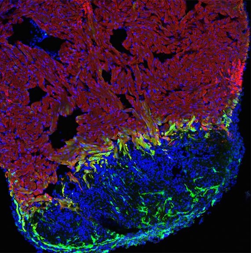 Mikroskopische_Aufnahme_regenerierendes_Herz_Chi_Chung_Wu_Uni_Ulm_04022016.jpg Mikroskopische Aufnahme eines Gewebeschnittes