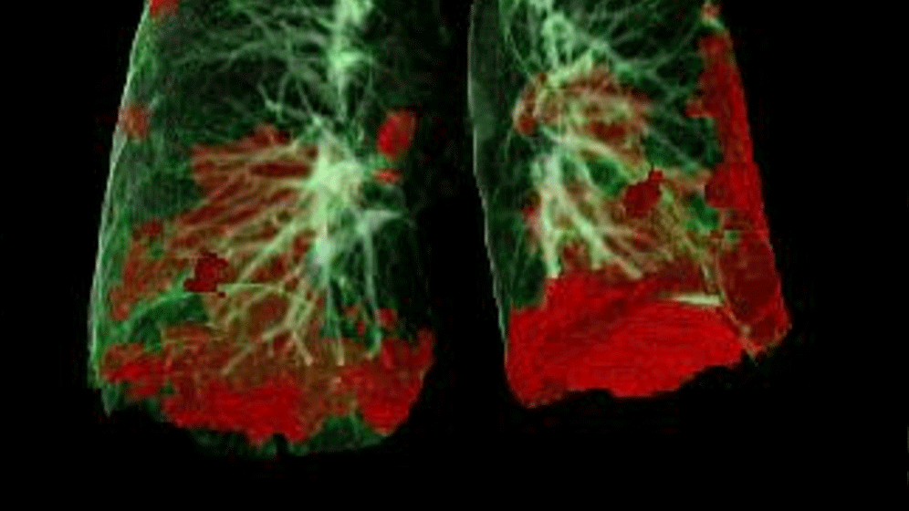 newsimage340042-1.gif COVID-19