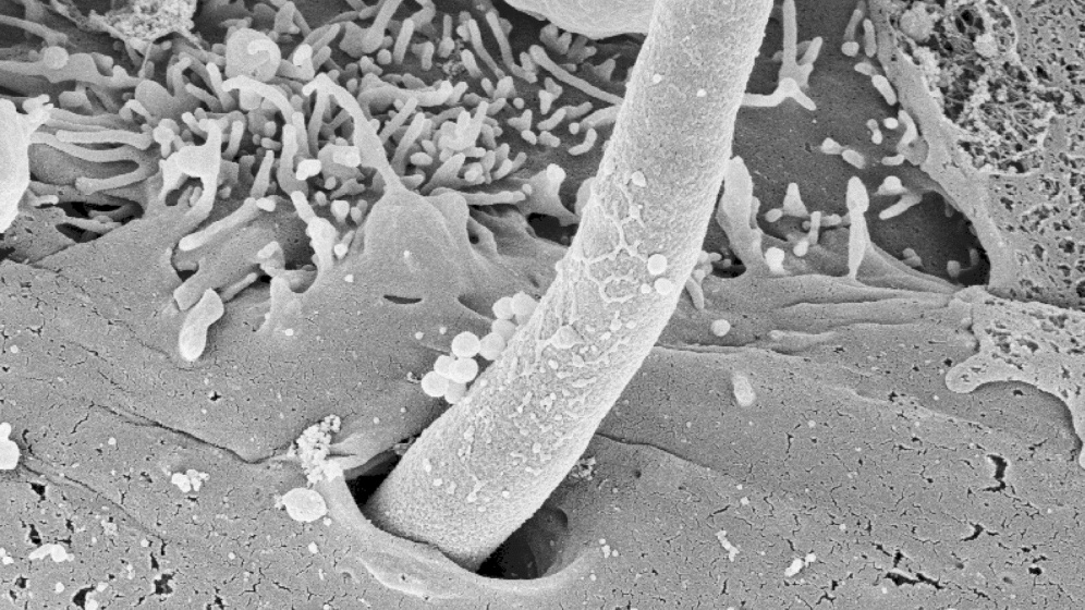 Eine_von_Candidaalbicans_gebildeteHyphe_dringt_in_Mundschleimhautzelle_ein_Holland_Oezel_Zakikha_02052016.jpg Fadenförmige Hyphe