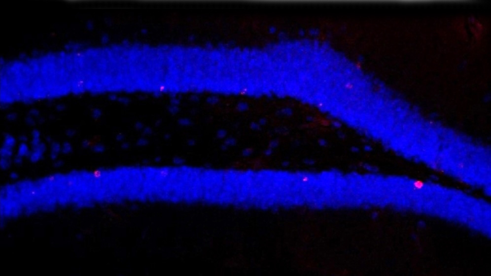 Hippocampus_nach_Behandlung_mit_Antibiotika_nur_wenige_neue_Zellen_rot_werden_gebildet_Susanne_Wolf_MDC_20052016.jpg Hippocampus nach Behandlung