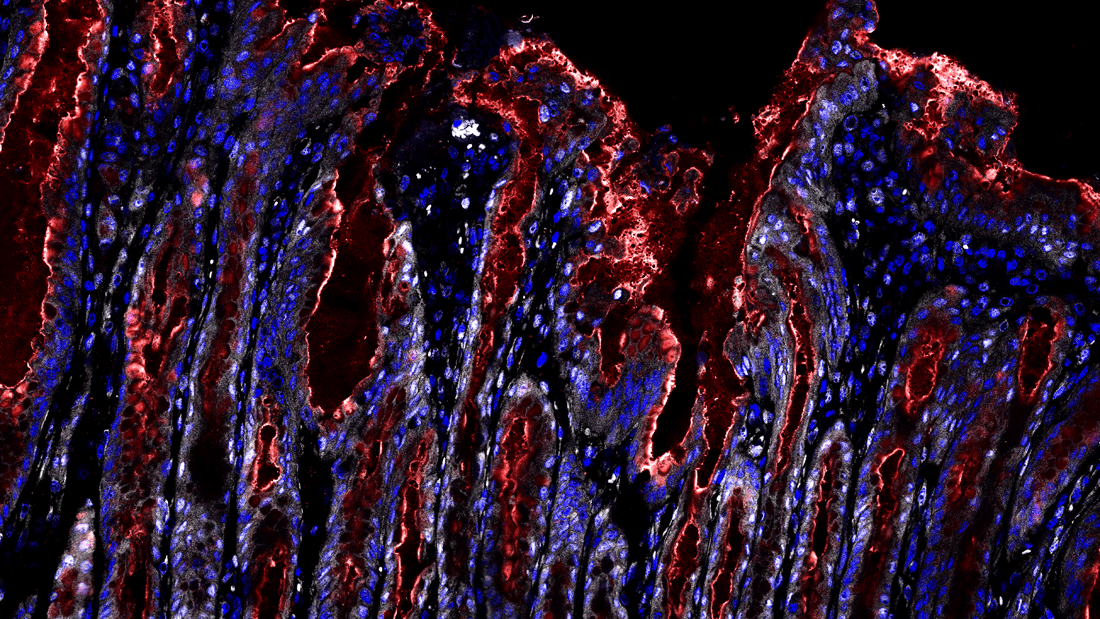 Sigal_Bmpr1a_KO_uninf_aYAP__white__MUC5AC__red_.gif Magenschleimhaut nach Infektion mit Helicobacter pylori. Was als Reparaturreaktion beginnt, wird bei jahrelanger Infektion zum Dauerzustand und schafft die Voraussetzungen für Krebsvorstufen. Rot gefärbt sind die schleimbildenden Oberflächenzellen. Weiß dargestellt ist der aktive Signalweg, der das Gewebe in einen stark wachsenden Zustand versetzt. Im gesunden Magen ist dieser fast vollständig ausgeschaltet.