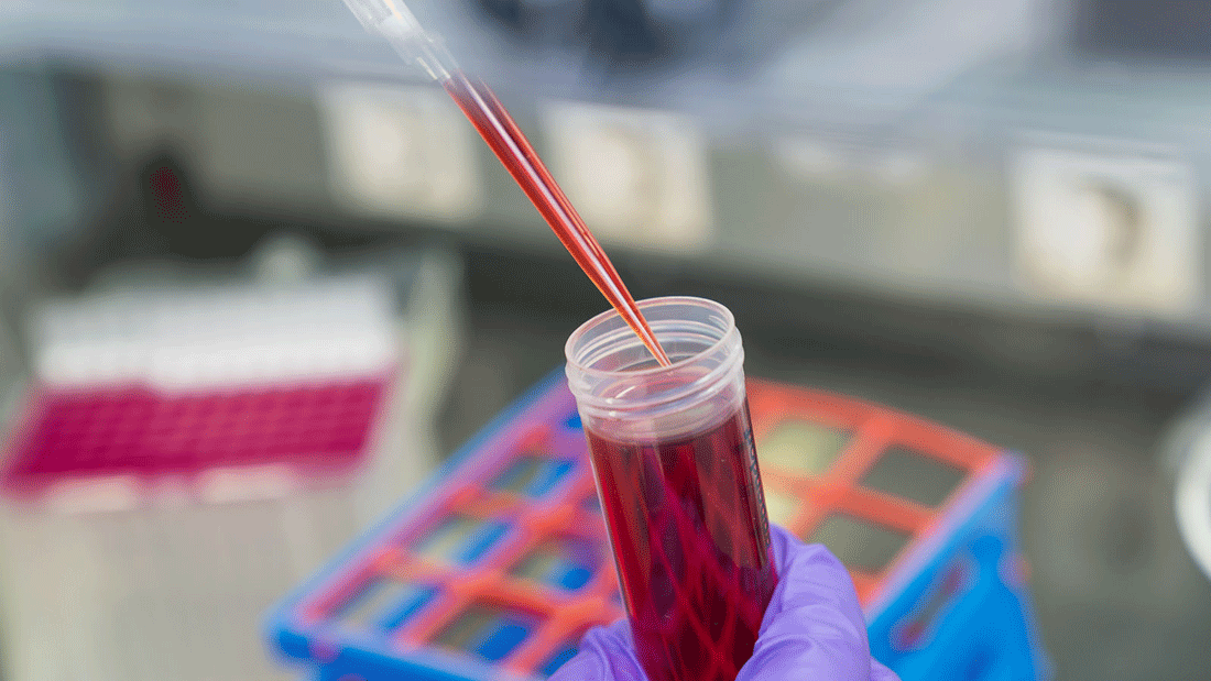 newsimage410309-_2_.gif Für das neue, nicht invasive Diagnostikverfahren wird zellfreie DNA aus dem Blut von Patienten isoliert.